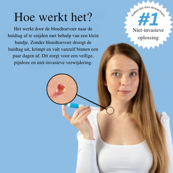 Zycon® | TagBuddy-set – Nooit meer huidtags