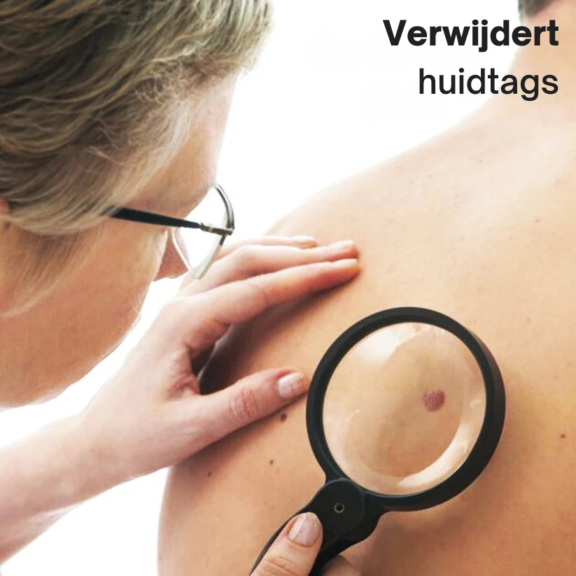 Zycon® Instant crème voor de behandeling van oneffenheden