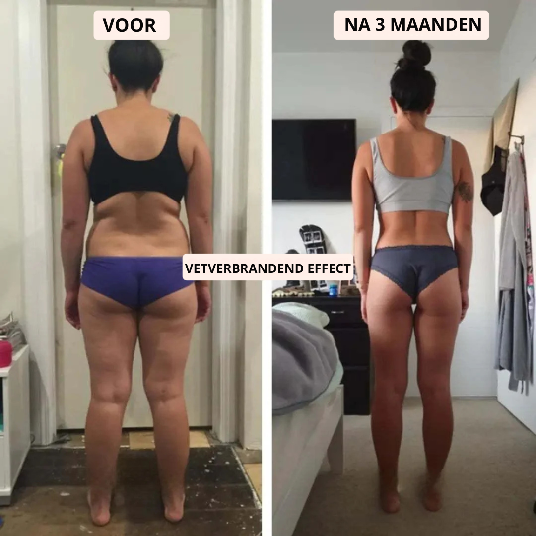 Zycon® 3D metabolismeverhogende legging