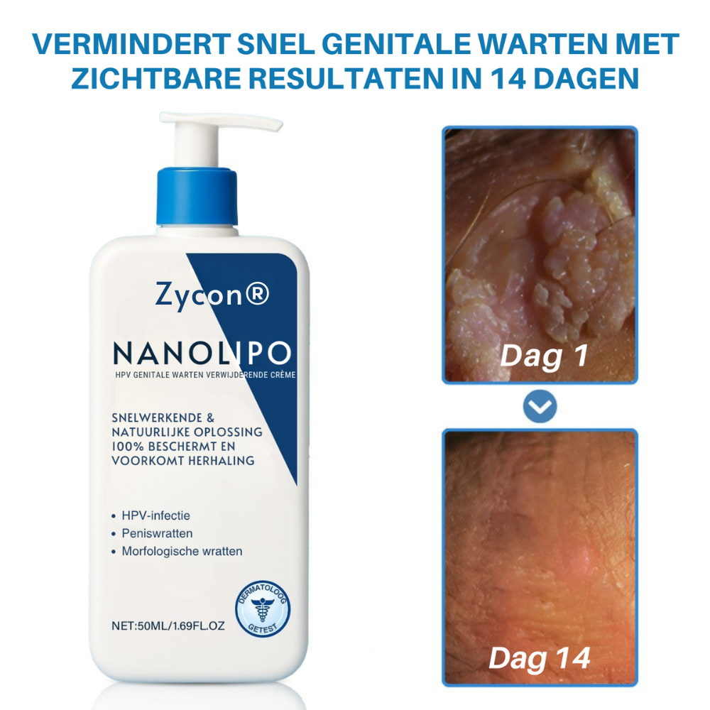 Zycon® NanoLipo Repair HPV Genitale Wratten Verwijderingscrème