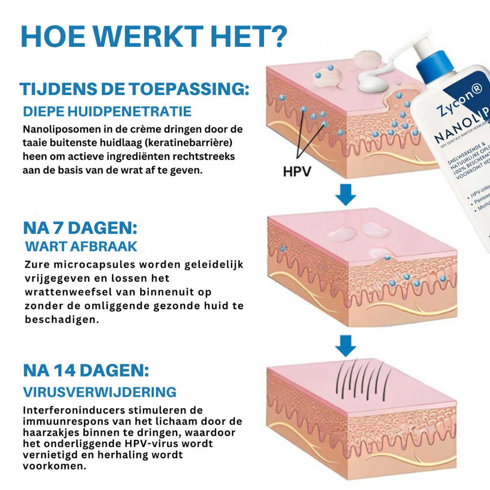 Zycon® NanoLipo Repair HPV Genitale Wratten Verwijderingscrème