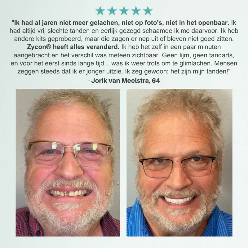 Zycon® medische volledige kunstgebit met sterke zuigkracht