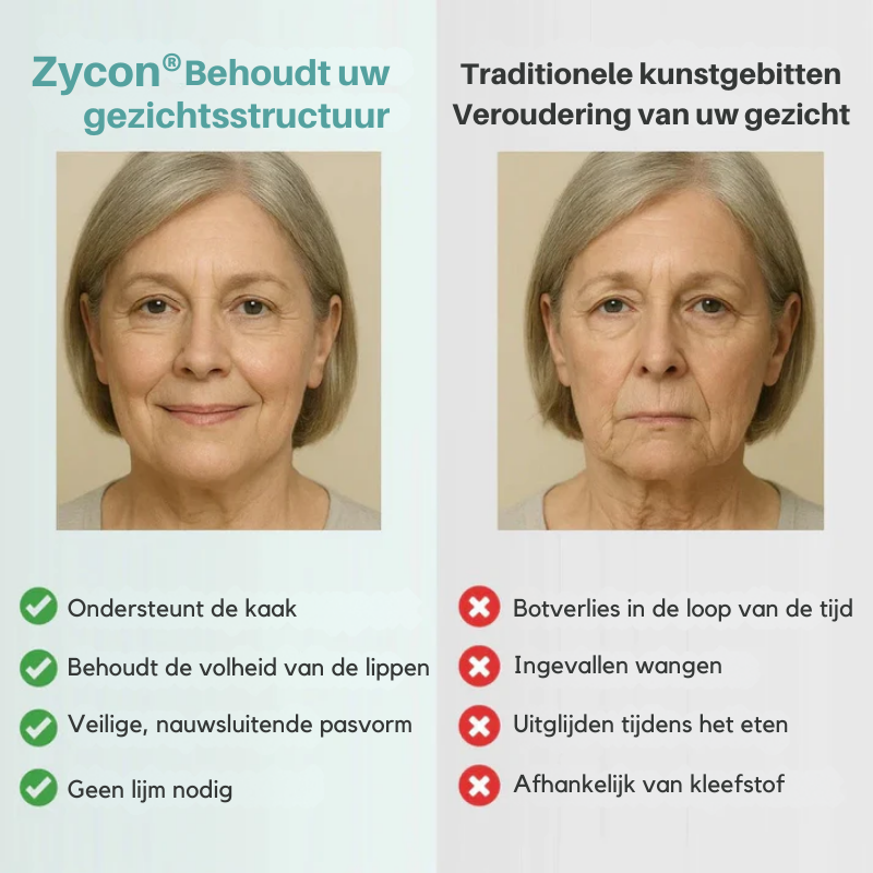 Zycon® medische volledige kunstgebit met sterke zuigkracht