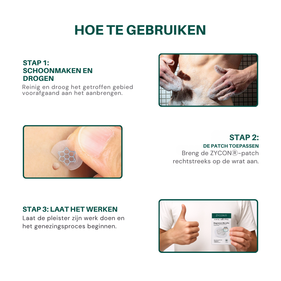 Zycon® Magnesium MicroPin HPV Genitale Wrat Verwijdering Patch