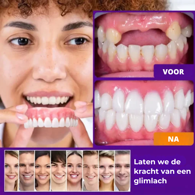 Zycon® Set van siliconen kunstgebitten