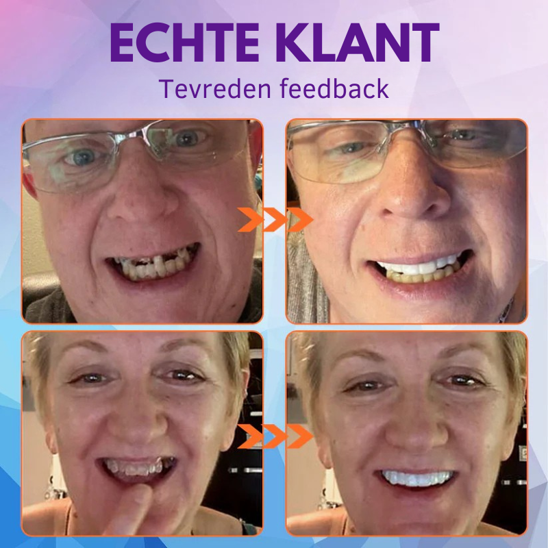 Zycon® Set van siliconen kunstgebitten