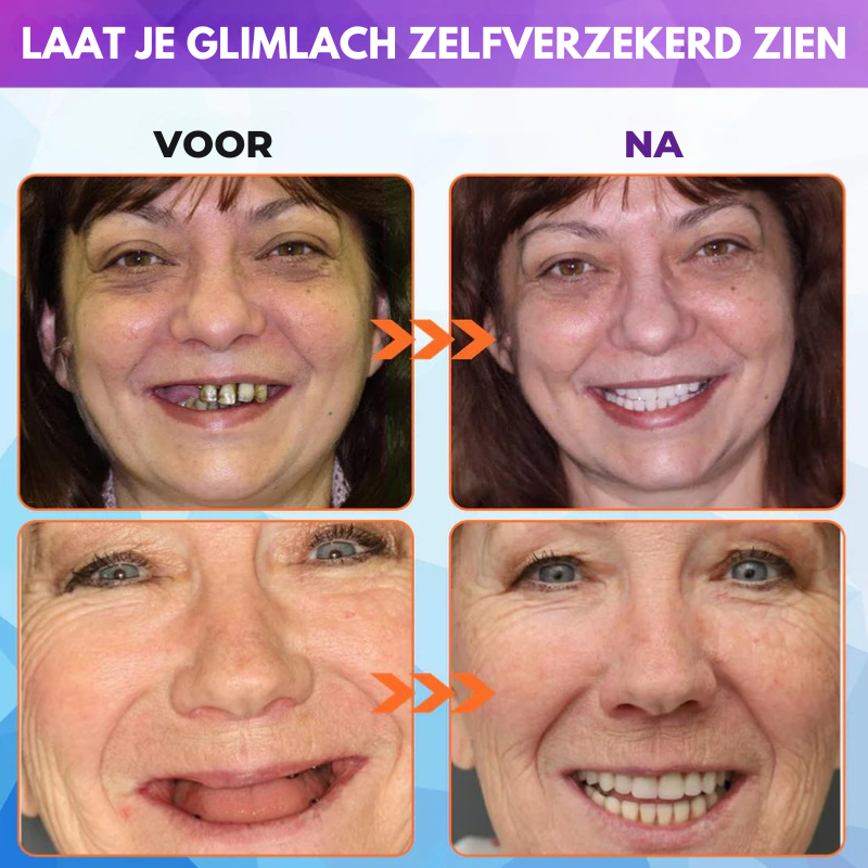 Zycon® Set van siliconen kunstgebitten