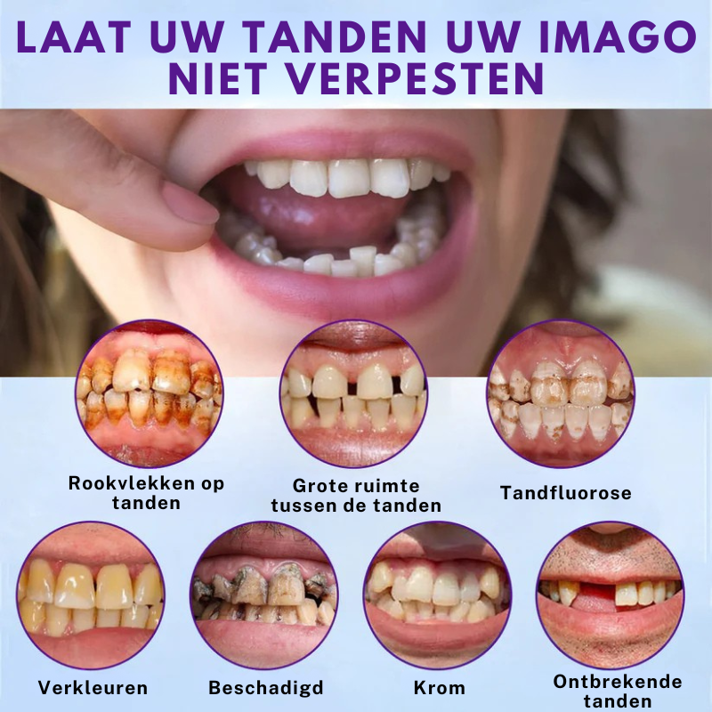 Zycon® Set van siliconen kunstgebitten