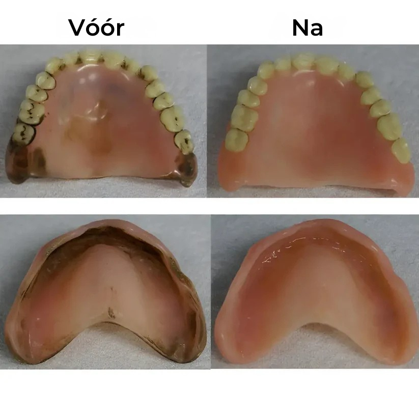 Zycon® Kunstgebit Reiniger – Dagelijkse Schoonmaak voor Prothese