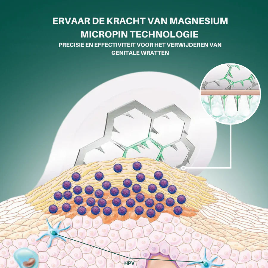 Zycon® Magnesium MicroPin HPV Genitale Wrat Verwijdering Patch
